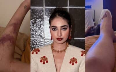 A Brave Reveal: Mamya Shajaffar Shares Her Battle with Lupus