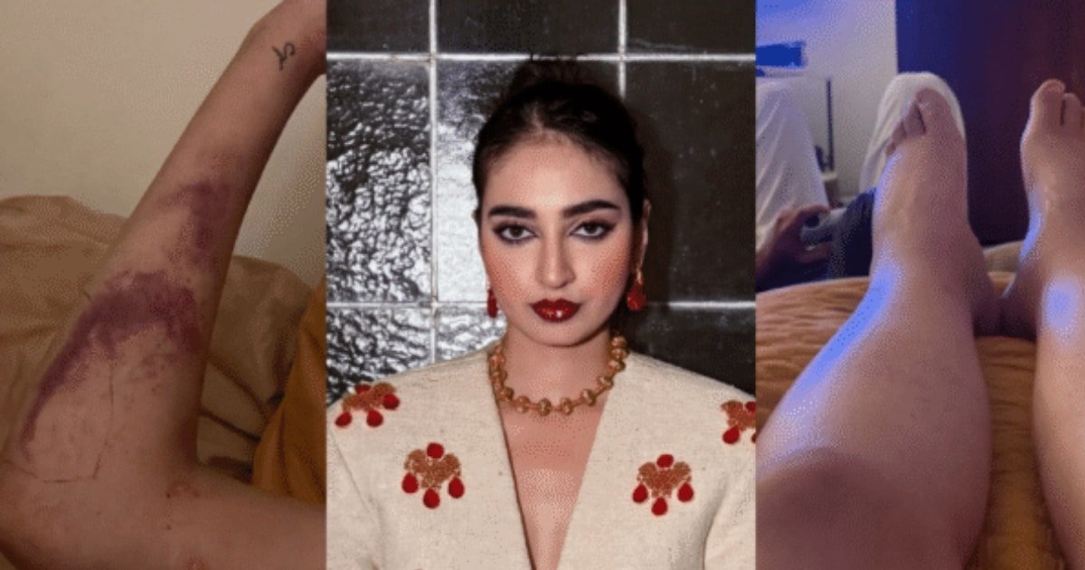 A Brave Reveal Mamya Shajaffar Shares Her Battle with Lupus