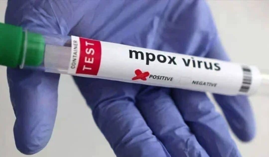 Experts Warn of Local Transmission of Mpox After Fatal Outbreak in Khairpur