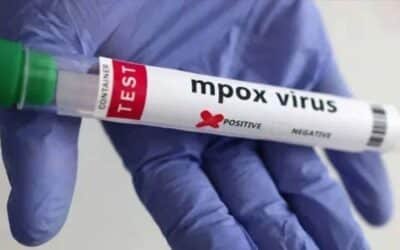 Experts Warn of Local Transmission of Mpox After Fatal Outbreak in Khairpur
