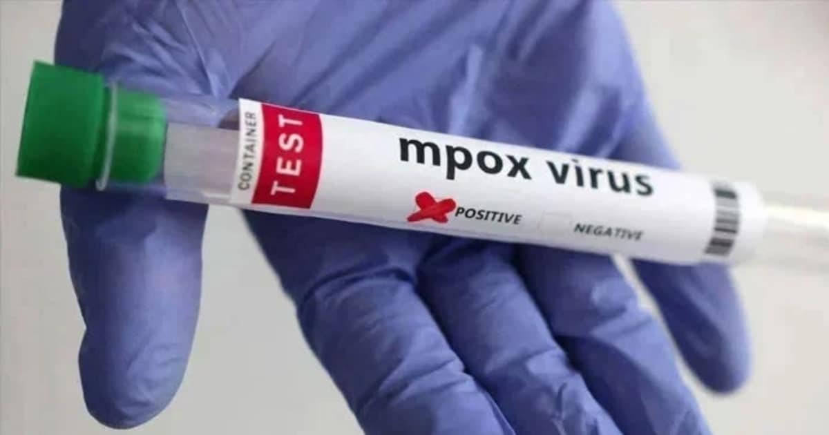 Experts Warn of Local Transmission of Mpox After Fatal Outbreak in Khairpur
