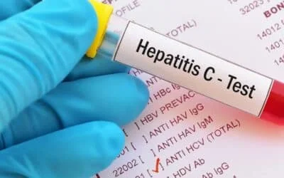 PMA sounds alarm on World Liver Day as Pakistan faces world’s highest Hepatitis C burden